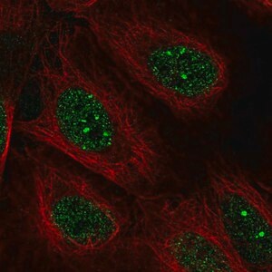 Merck Anti-POLK antibody produced in rabbit