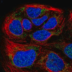 Merck Anti-HPDL antibody produced in rabbit