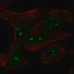 Merck Anti-MYCN antibody produced in rabbit