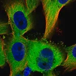 Merck Anti-TTC1 antibody produced in rabbit