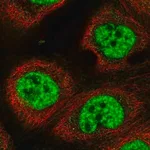 Merck Anti-RBM10 antibody produced in rabbit