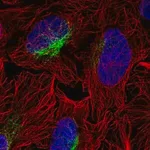 Merck Anti-ZCCHC9 antibody produced in rabbit