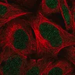 Merck Anti-C11orf1 antibody produced in rabbit