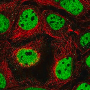 Merck Anti-RSF1 antibody produced in rabbit