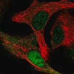 Merck Anti-CDK2AP1 antibody produced in rabbit