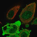 Merck Anti-ANKRD36 antibody produced in rabbit