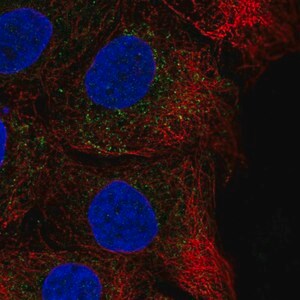 Merck Anti-CHST14 antibody produced in rabbit