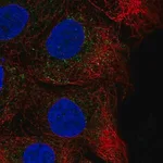 Merck Anti-CHST14 antibody produced in rabbit