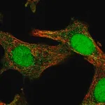 Merck Anti-SOCS4 antibody produced in rabbit