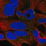 Merck Anti-PLCH1 antibody produced in rabbit