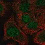 Merck Anti-NOTCH1 antibody produced in rabbit