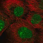 Merck Anti-MFSD1 antibody produced in rabbit