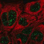 Merck Anti-MED7 antibody produced in rabbit