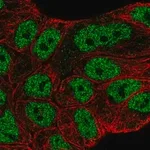 Merck Anti-ABCA6 antibody produced in rabbit
