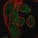 Merck Anti-RBM24 antibody produced in rabbit