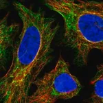 Merck Anti-EPPK1 antibody produced in rabbit