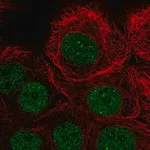 Merck Anti-PIAS3 antibody produced in rabbit