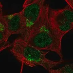 Merck Anti-TBC1D14 antibody produced in rabbit