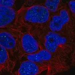 Merck Anti-RTEL1 antibody produced in rabbit