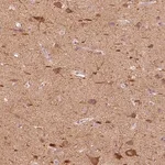 Merck Anti-C20orf194 antibody produced in rabbit