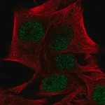 Merck Anti-PRDM4 antibody produced in rabbit