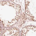 Merck Anti-GMEB2 antibody produced in rabbit
