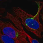 Merck Anti-C19orf25 antibody produced in rabbit
