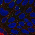 Merck Anti-DAB1 antibody produced in rabbit