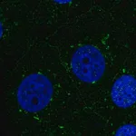 Merck Anti-PSEN1 antibody produced in rabbit