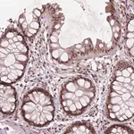 Merck Anti-GPS2 antibody produced in rabbit