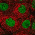 Merck Anti-MBD2 antibody produced in rabbit