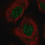 Merck Anti-RSRP1 antibody produced in rabbit