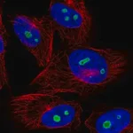 Merck Anti-NOC3L antibody produced in rabbit