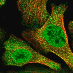 Merck Anti-N4BP2 antibody produced in rabbit