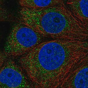 Merck Anti-QTRT1 antibody produced in rabbit