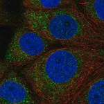 Merck Anti-QTRT1 antibody produced in rabbit