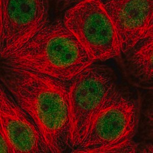 Merck Anti-ZNF821 antibody produced in rabbit