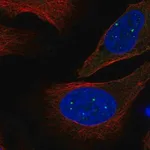 Merck Anti-EVI5L antibody produced in rabbit