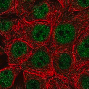 Merck Anti-CARM1 antibody produced in rabbit