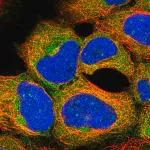 Merck Anti-AKT1S1 antibody produced in rabbit