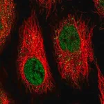 Merck Anti-IFI44 antibody produced in rabbit