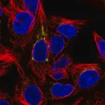 Merck Anti-FUT6 antibody produced in rabbit