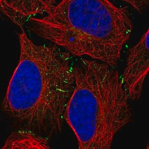 Merck Anti-VPS13B antibody produced in rabbit