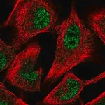 Merck Anti-PFKFB3 antibody produced in rabbit