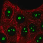 Merck Anti-SETMAR antibody produced in rabbit