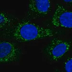 Merck Anti-KCTD18 antibody produced in rabbit
