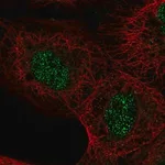 Merck Anti-ASXL2 antibody produced in rabbit