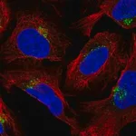 Merck Anti-AP1AR antibody produced in rabbit
