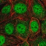 Merck Anti-SKP1 antibody produced in rabbit