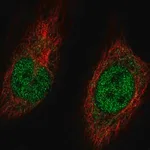 Merck Anti-MGA antibody produced in rabbit